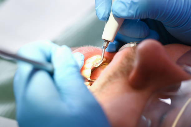 Best Same-Day Emergency Dentist in Jamestown, ND
