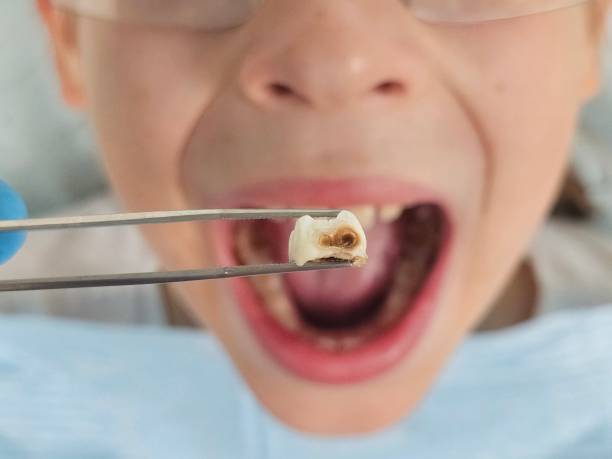 Best Pediatric Emergency Dentist in Jamestown, ND